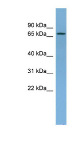 NDUFS1 antibody LS-C116644 Western blot of Fetal Liver lysate.