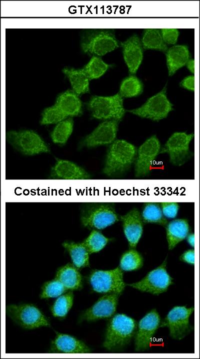 Immunofluorescence of methanol-fixed A431 using NDUFS1 antibody at 1:200 dilution.