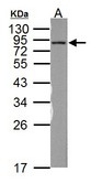 Sample (50 ug of whole cell lysate). A: Rat brain. 12% SDS PAGE. NDUFS1 antibody diluted at 1:1000.