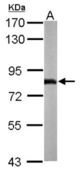 Sample (50 ug of whole cell lysate). A: Mouse brain. 7.5% SDS PAGE. NDUFS1 antibody diluted at 1:1000.