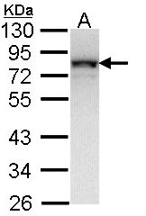 Sample (30 ug of whole cell lysate). A: Molt-4 . 12% SDS PAGE. NDUFS1 antibody diluted at 1:1000.