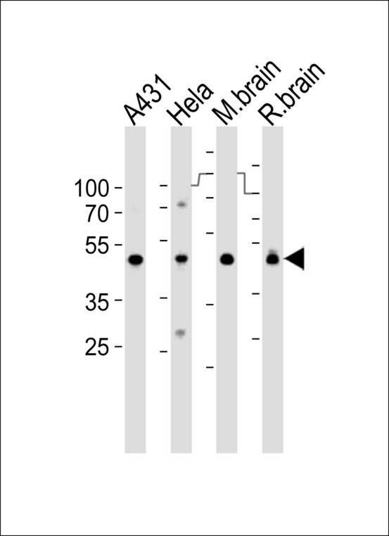 Western blot of lysates from A431, HeLa cell line, mouse brain and rat brain tissue lysate(from left to right), using NDUFS2 Antibody. Antibody was diluted at 1:1000 at each lane. A goat anti-rabbit IgG H&L (HRP) at 1:10000 dilution was used as the secondary antibody. Lysates at 35ug per lane.