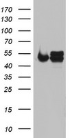 HEK293T cells were transfected with the pCMV6-ENTRY control (Left lane) or pCMV6-ENTRY NDUFS2 (Right lane) cDNA for 48 hrs and lysed. Equivalent amounts of cell lysates (5 ug per lane) were separated by SDS-PAGE and immunoblotted with anti-NDUFS2.