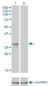Western blot of NDUFS3 over-expressed 293 cell line, cotransfected with NDUFS3 Validated Chimera RNAi (Lane 2) or non-transfected control (Lane 1). Blot probed with NDUFS3 monoclonal antibody, clone 1D6. GAPDH ( 36.1 kD ) used as specific.