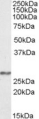Antibody (0.3 ug/ml) staining of Human Frontal Cortex lysate (35 ug protein in RIPA buffer). Primary incubation was 1 hour. Detected by chemiluminescence.