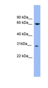 NDUFS3 antibody LS-C107587 Western blot of Placenta lysate.