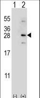 Western blot of NDUFS4 (arrow) using rabbit polyclonal NDUFS4 Antibody. 293 cell lysates (2 ug/lane) either nontransfected (Lane 1) or transiently transfected (Lane 2) with the NDUFS4 gene.