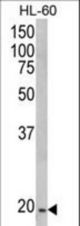 Western blot of NDUFS4 Antibody in HL-60 cell line lysates (35 ug/lane). NDUFS4 (arrow) was detected using the purified antibody.