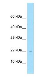 NDUFS4 antibody Western Blot of Fetal Lung.