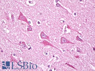 Anti-NDUFS7 antibody IHC of human brain, cortex neurons. Immunohistochemistry of formalin-fixed, paraffin-embedded tissue after heat-induced antigen retrieval. Antibody LS-B7809 dilution 5 ug/ml.