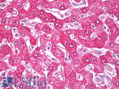 Anti-NDUFS7 antibody IHC of human liver. Immunohistochemistry of formalin-fixed, paraffin-embedded tissue after heat-induced antigen retrieval. Antibody LS-B7809 dilution 5 ug/ml.