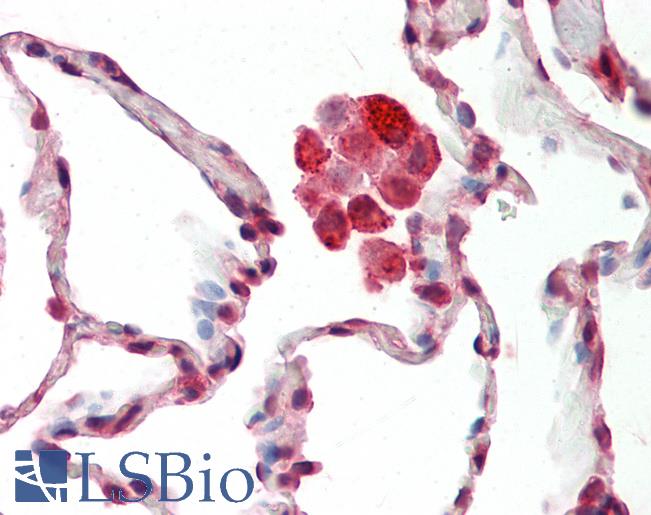 Anti-NDUFS8 antibody IHC staining of human lung. Immunohistochemistry of formalin-fixed, paraffin-embedded tissue after heat-induced antigen retrieval. Antibody LS-B11485 concentration 10 ug/ml.
