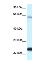 NDUFS8 antibody LS-B11485 Western blot of Fetal Heart lysate. Antibody concentration 1 ug/ml.