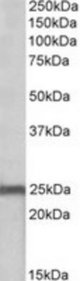 NDUFS8 antibody (0.1 ug/ml) staining of Mouse Heart lysate (35 ug protein/ml in RIPA buffer). Primary incubation was 1 hour. Detected by chemiluminescence.