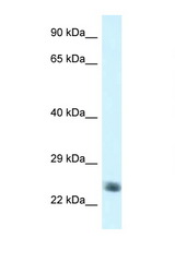 NDUFS8 antibody LS-C145474 Western blot of Jurkat Cell lysate. Antibody concentration 1 ug/ml.
