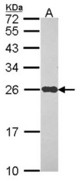 Sample (30 ug of whole cell lysate). A: Hep G2 . 12% SDS PAGE. NDUFS8 antibody. NDUFS8 antibody diluted at 1:1000.