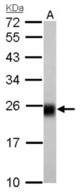 NDUFS8 antibody detects NDUFS8 protein by Western blot analysis. A. 50 ug rat brain lysate/extract. 12 % SDS-PAGE. NDUFS8 antibody dilution:1:1000