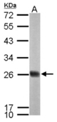 Sample (50 ug of whole cell lysate). A: mouse brain. 12% SDS PAGE. NDUFS8 antibody diluted at 1:1000.
