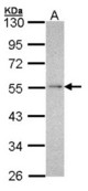 Sample (30 ug of whole cell lysate). A: Hep G2 . 10% SDS PAGE. NDUFV1 antibody diluted at 1:1000.
