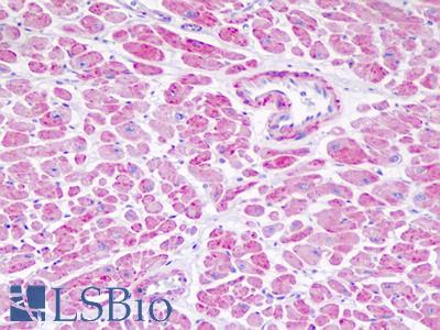 Anti-NDUFV1 antibody IHC staining of human heart. Immunohistochemistry of formalin-fixed, paraffin-embedded tissue after heat-induced antigen retrieval.