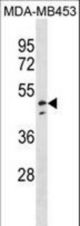 NDUFV1 Antibody western blot of MDA-MB453 cell line lysates (35 ug/lane). The NDUFV1 antibody detected the NDUFV1 protein (arrow).