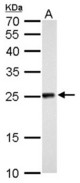 NDUFV2 antibody detects NDUFV2 protein by Western blot analysis. A. 50 ug rat liver lysate/extract. 12 % SDS-PAGE. NDUFV2 antibody dilution:1:500