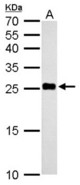NDUFV2 antibody detects NDUFV2 protein by Western blot analysis. A. 50 ug mouse liver lysate/extract. 12 % SDS-PAGE. NDUFV2 antibody dilution:1:500