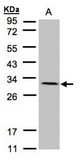 Sample (30 ug of whole cell lysate). A: A431. 12% SDS PAGE. NDUFV2 antibody diluted at 1:1500.