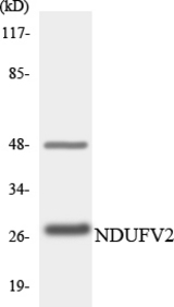 Western blot of the lysates from K562 cells using NDUFV2 antibody.