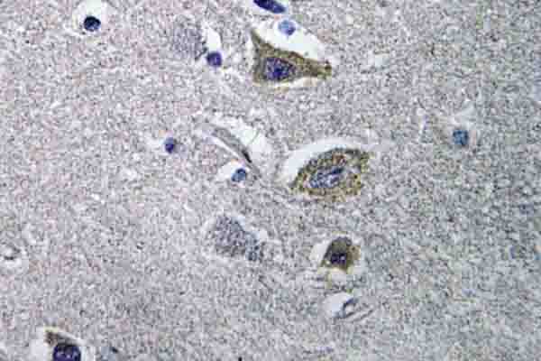 IHC of NDUFV2 (P52) pAb in paraffin-embedded human brain tissue.