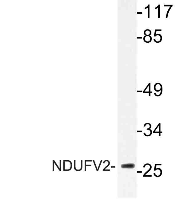 Western blot of NDUFV2 (P52) pAb in extracts from Jurkat cells.