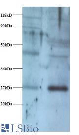 Western blot of NADH dehydrogenase flavoprotein 2, mitochondrial antibody at 2 ug/ml. Lane 1: EC109 whole cell lysate. Lane 2: 293T whole cell lysate. Secondary: Goat polyclonal to Rabbit IgG at 1:15000 dilution. Predicted band size: 27 kDa. Observed band size: 27 kDa Additional bands at: 40 kDa. We are unsure as to the identity of this extra band.