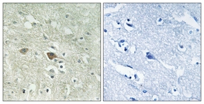 IHC of paraffin-embedded human brain, using NDUFV3 Antibody. The picture on the right is treated with the synthesized peptide.