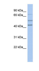 NEDD1 antibody LS-C111478 Western blot of Fetal Spleen lysate.