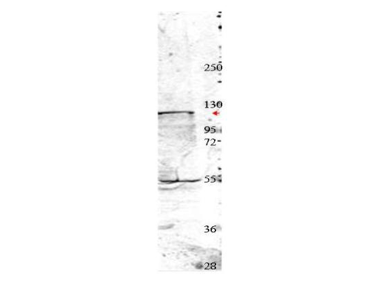 Anti-Nedd4 Antibody - Western Blot. Western blot of affinity purified anti-Nedd4 antibody shows detection of a 115 kD band corresponding to endogenous Nedd4 (arrowhead) in MDA-MB-435S cell lysates. The blot was blocked with B501-0500 5% BLOTTO overnight at 4C. Primary antibody was used at a 1:350 dilution in 5% BLOTTO followed by reaction with a 1:20000 dilution of HRP goat anti-rabbit IgG in #MB-070 Blocking Buffer for Fluorescent Western Blot. ECL was used for detection.