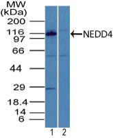 Western blot of NEDD4 in mouse embryo brain tissue lysate in the 1) absence and 2) presence of immunizing peptide using LS-C148723 at 5 ug/ml. Goat anti-rabbit Ig HRP secondary antibody, and PicoTect ECL substrate solution were used for this test.