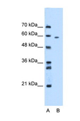 MDM4 / MDMX antibody LS-C31169 Western blot of HepG2 Cell lysate. Antibody concentration 1 ug/ml.