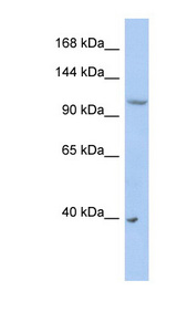 NEDD4L antibody LS-C110766 Western blot of PANC1 cell lysate.
