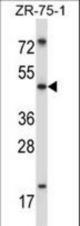 MDM4 Antibody western blot of ZR-75-1 cell line lysates (35 ug/lane). The MDM4 antibody detected the MDM4 protein (arrow).