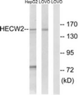 Western blot of extracts from LOVO/HepG2 cells, using HECW2 Antibody. The lane on the right is treated with the synthesized peptide.