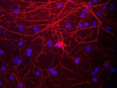 Immunofluorescent staining using NEFM antibody. Immunofluorescent staining of cultured rat neurons and glia showing labeling of NEFM in red