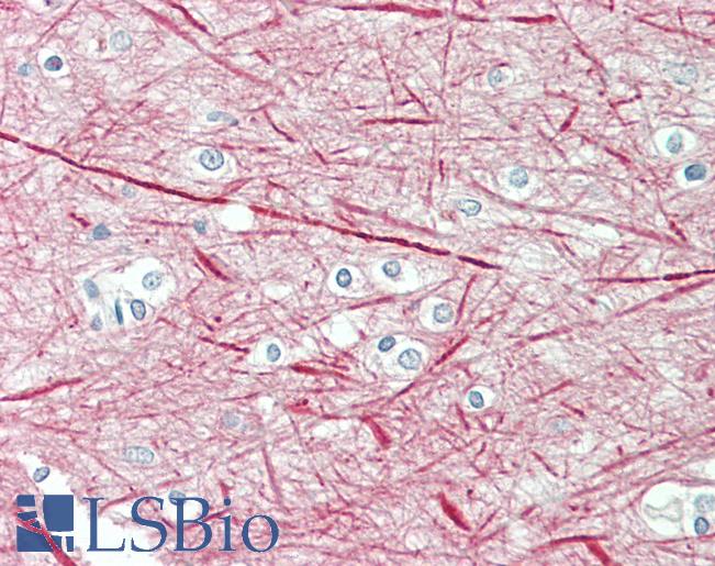Anti-NEFM / NF-M antibody IHC staining of human brain, cortex. Immunohistochemistry of formalin-fixed, paraffin-embedded tissue after heat-induced antigen retrieval. Antibody LS-B11174 concentration 5 ug/ml.