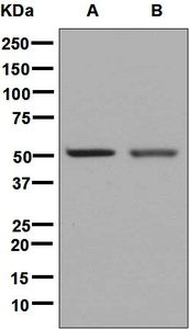 Western blot analysis on (A) fetal brain and (B) human hippocampus lysates using anti-NEGR1 antibody.