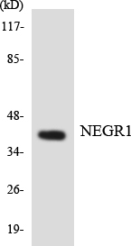 Western blot of the lysates from COLO205 cells using NEGR1 antibody.
