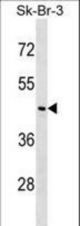 NEGR1 Antibody western blot of SK-BR-3 cell line lysates (35 ug/lane). The NEGR1 antibody detected the NEGR1 protein (arrow).