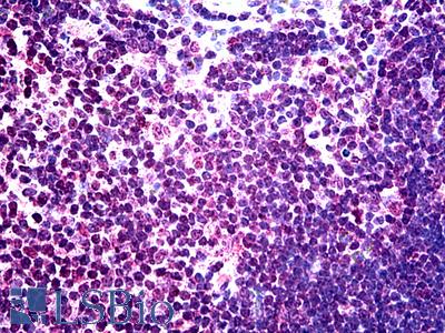 Anti-NEIL3 antibody IHC of human thymus. Immunohistochemistry of formalin-fixed, paraffin-embedded tissue after heat-induced antigen retrieval. Antibody LS-B4815 concentration 10 ug/ml.