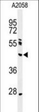 Western blot of NEIL1 Antibody in A2058 cell line lysates (35 ug/lane). NEIL1 (arrow) was detected using the purified antibody.