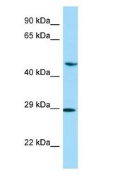 NEIL1 antibody Western Blot of PANC1.