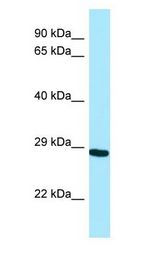 NEIL2 antibody Western Blot of THP-1.
