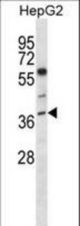 NEIL2 Antibody western blot of HepG2 cell line lysates (35 ug/lane). The NEIL2 antibody detected the NEIL2 protein (arrow).